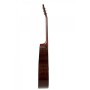 Ovation Applause AAD-96-4 Akustik Gitar